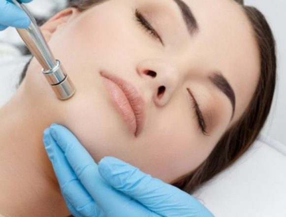 Diamond microdermabrasion 1