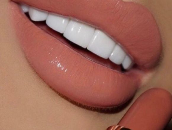 TEETH WHITENING2