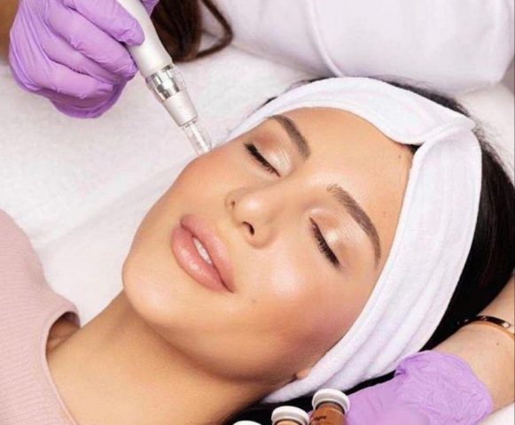 skin-needling-sydney
